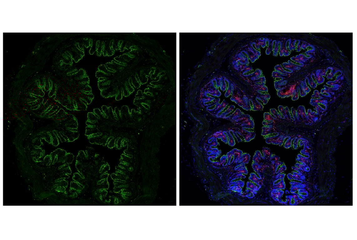 Immunofluorescence Image 4: Cathepsin D (E5V4H) Rabbit mAb