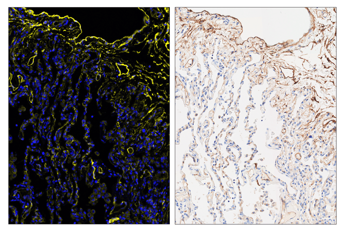 Immunohistochemistry Image 6: NT5E/CD73 (D7F9A) & CO-0039-750 SignalStar<sup>™</sup> Oligo-Antibody Pair