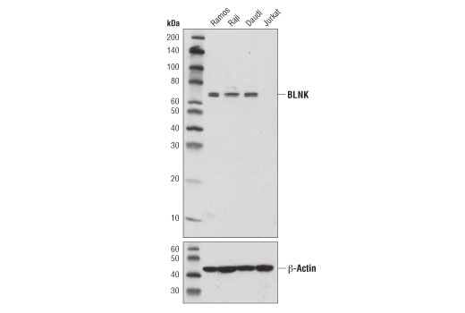 Western Blotting Image 1: BLNK (D3P2H) XP<sup>®</sup> Rabbit mAb (BSA and Azide Free)