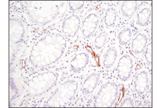 undefined Image 23: Extracellular Matrix Dynamics Antibody Sampler Kit