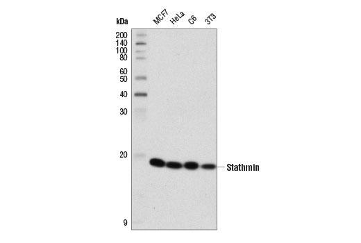 Immature Neuron Marker Antibody Sampler Kit: Image 1