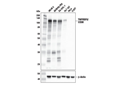 Western Blotting Image 3: TNFRSF8/CD30 (E4L4I) XP<sup>®</sup> Rabbit mAb (BSA and Azide Free)