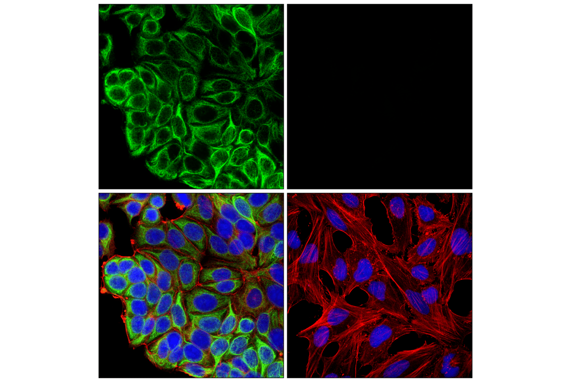 Immunofluorescence Image 1: Keratin 19 (BA17) Mouse mAb