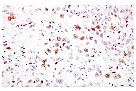 Immunohistochemistry Image 3: DNMT1 (D63A6) XP<sup>®</sup> Rabbit mAb (BSA and Azide Free)