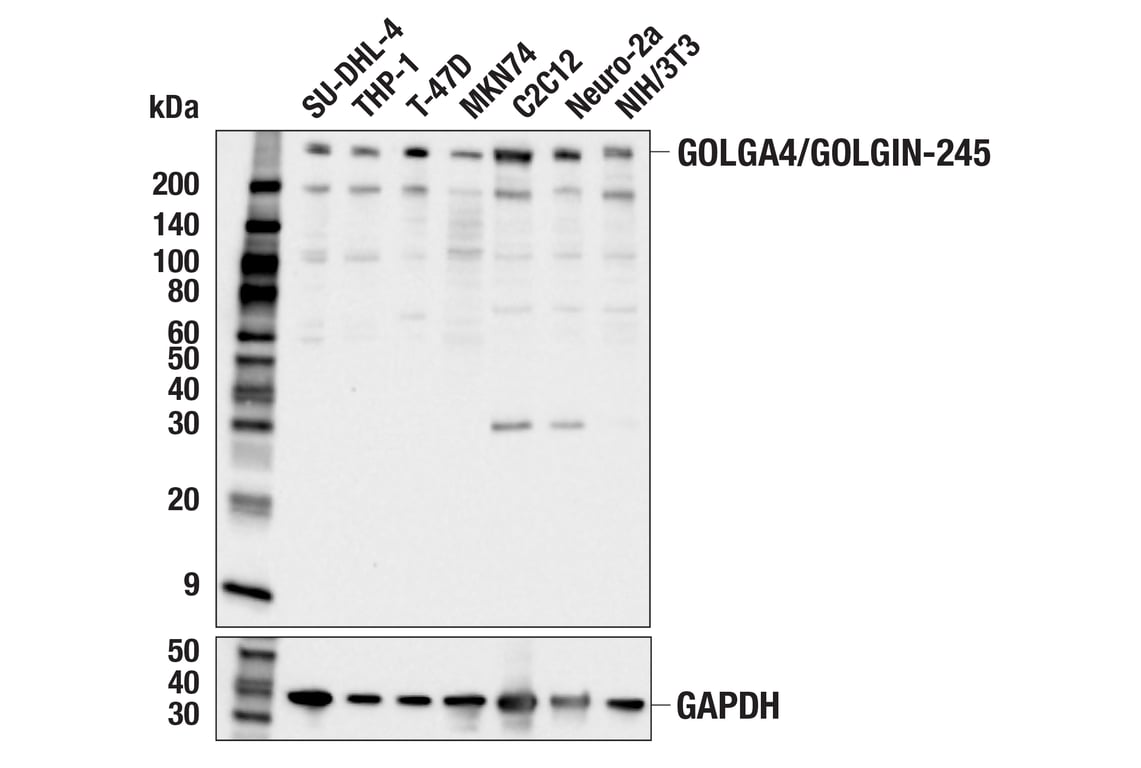 Western Blotting Image 1: GOLGA4/GOLGIN-245 (E2V6G) Rabbit mAb