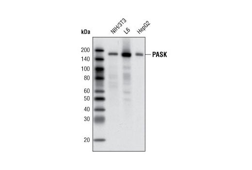 Western Blotting Image 1: PASK (C70B2) Rabbit mAb