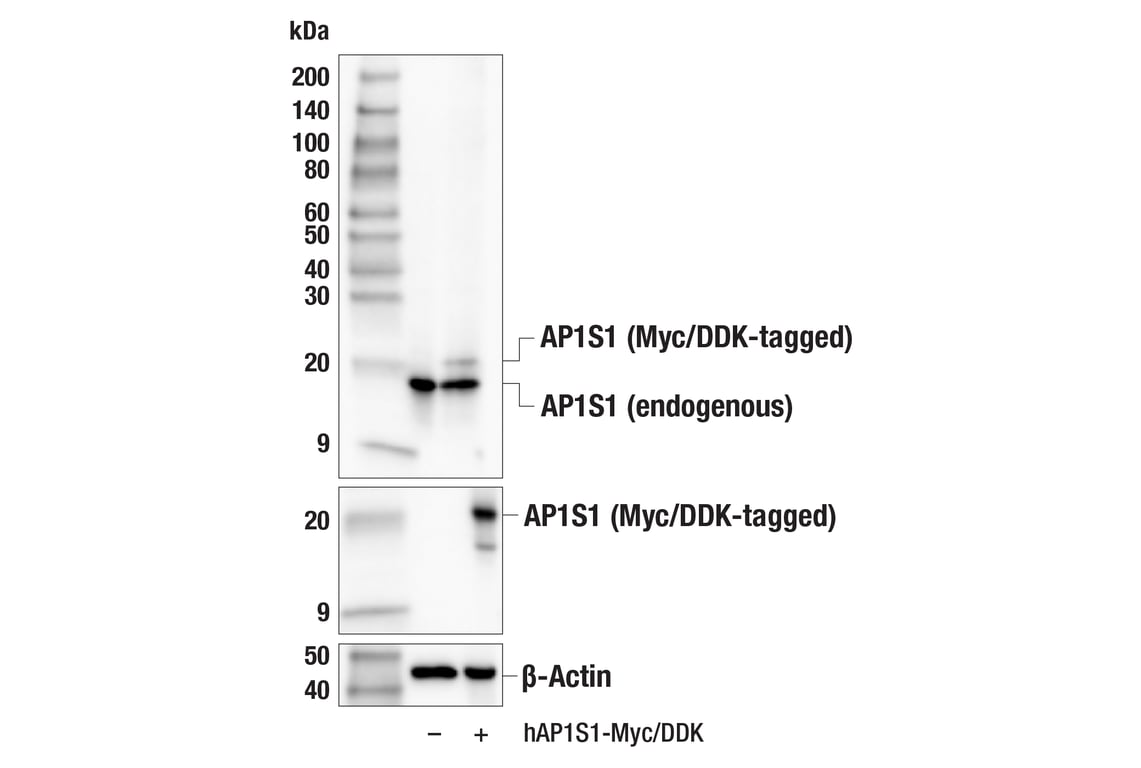 Western Blotting Image 2: AP1S1 (F8K5S) Rabbit mAb