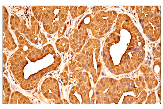 Immunohistochemistry Image 1: Ubiquitin (E6K4Y) XP<sup>®</sup> Rabbit mAb (BSA and Azide Free)