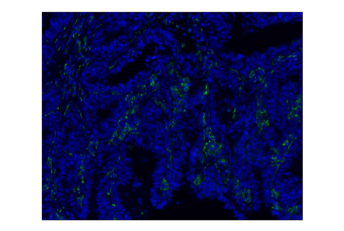 Immunohistochemistry Image 1: CD163 (D6U1J) Rabbit mAb (Alexa Fluor<sup>®</sup> 488 Conjugate)