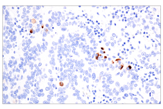 Immunohistochemistry Image 3: TIMP1 (D10E6) Rabbit mAb (BSA and Azide Free)