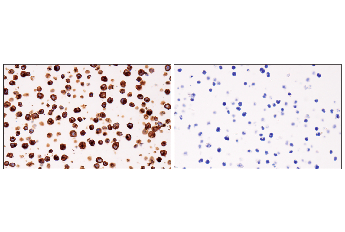 Immunohistochemistry Image 11: HLA-DRA (E9R2Q) XP<sup>®</sup> Rabbit mAb
