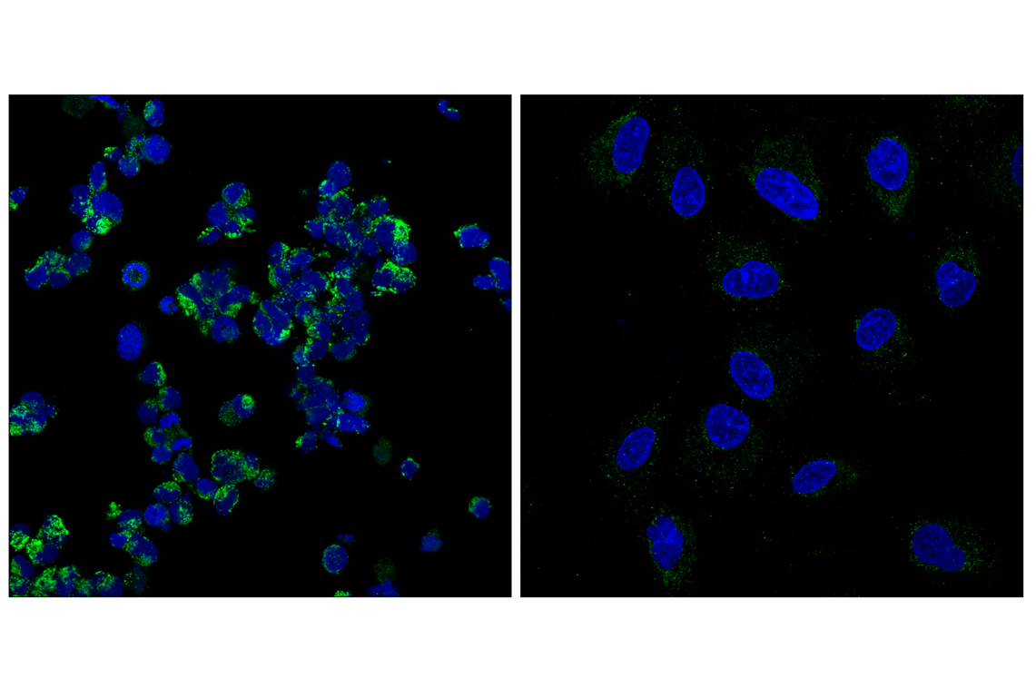 Immunofluorescence Image 1: GCDH (F2P2M) Rabbit mAb