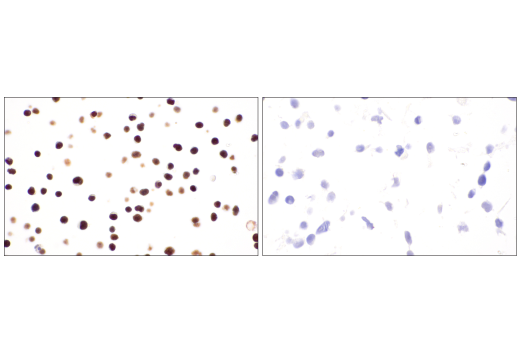 undefined Image 64: BAF Complex IHC Antibody Sampler Kit