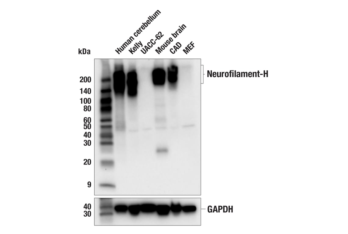 Western Blotting Image 1: Neurofilament-H (E3O6W) Mouse mAb