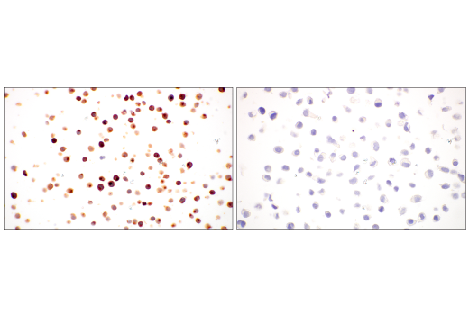 Immunohistochemistry Image 4: CD7 (E4G1Q) XP<sup>®</sup> Rabbit mAb (BSA and Azide Free)