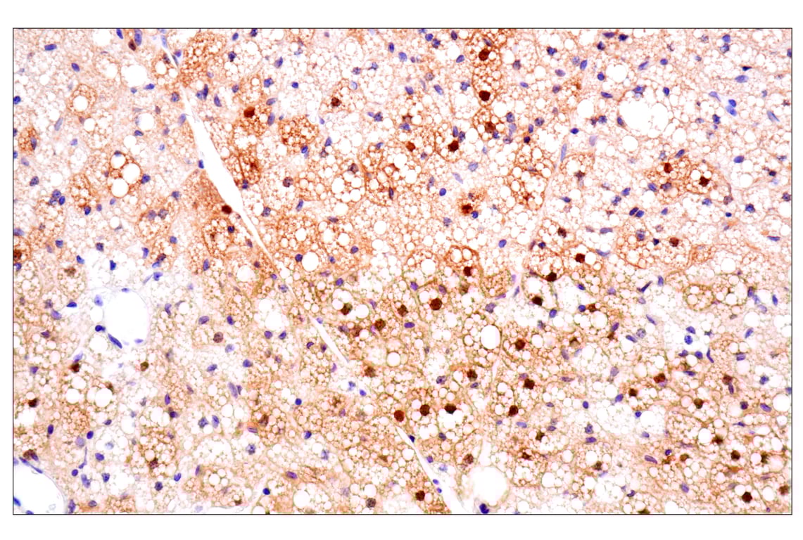 Immunohistochemistry Image 14: ACBP/DBI (E4V8V) XP<sup>®</sup> Rabbit mAb