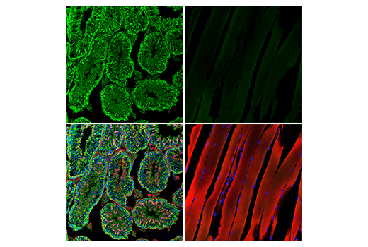 undefined Image 9: Parthanatos Antibody Sampler Kit