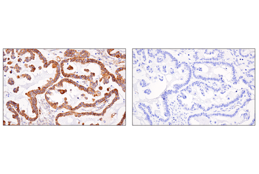 Immunohistochemistry Image 4: APP (E3F3P) Rabbit mAb