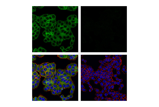 Immunofluorescence Image 1: RIP (E8S7U) XP<sup>®</sup> Rabbit mAb