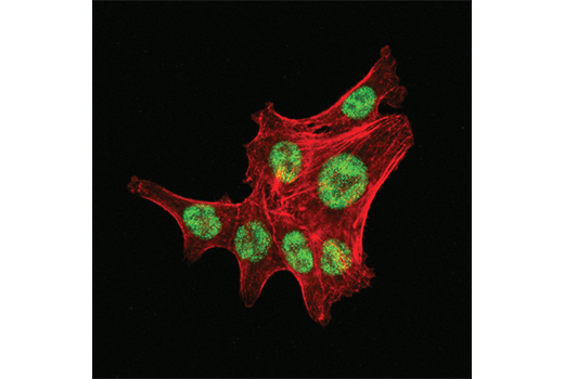 Immunofluorescence Image 2: LRF/Pokemon (D7U2O) Rabbit mAb