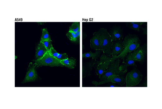 Immunofluorescence Image 1: IQGAP1 (D8K4X) XP<sup>®</sup> Rabbit mAb