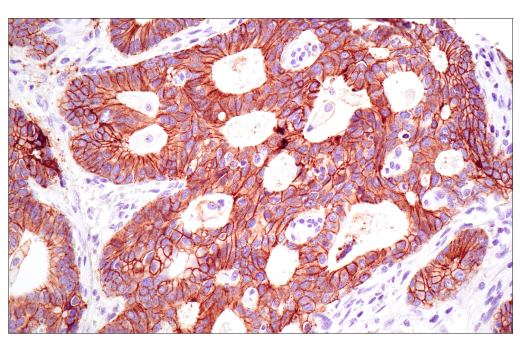 Immunohistochemistry Image 1: E-Cadherin (4A2) Mouse mAb