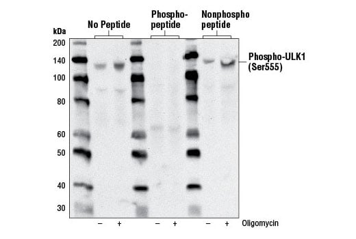 undefined Image 5: PhosphoPlus<sup>®</sup> ULK1 (Ser555) Antibody Duet