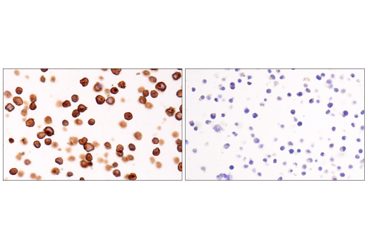 Immunohistochemistry Image 2: CD20 (L26) Mouse mAb