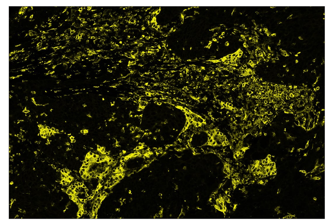 Immunohistochemistry Image 3: HLA-DRA (E9R2Q) & CO-0023-750 SignalStar<sup>™</sup> Oligo-Antibody Pair