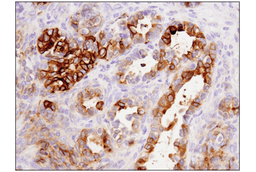 Immunohistochemistry Image 3: Tissue Factor/CD142 (E9M6T) XP<sup>®</sup> Rabbit mAb