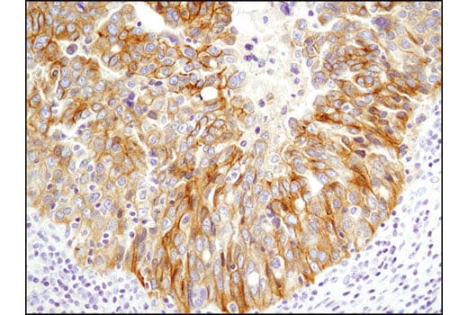 Immunohistochemistry Image 3: HER3/ErbB3 (D22C5) XP<sup>®</sup> Rabbit mAb