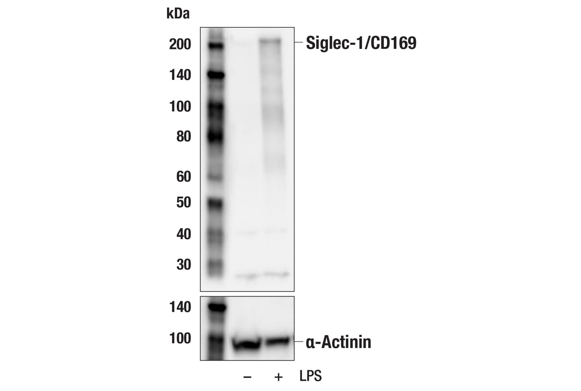 Western Blotting Image 3: Siglec-1/CD169 (E1D7G) Rabbit mAb