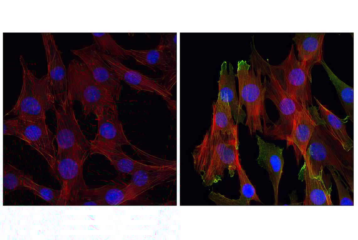 Immunofluorescence Image 1: Phospho-Akt (Ser473) (D9E) XP<sup>®</sup> Rabbit mAb (BSA and Azide Free)