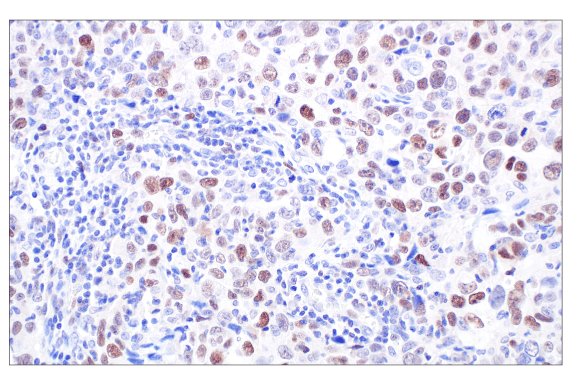 Immunohistochemistry Image 2: MASTL (F7I2C) Rabbit mAb