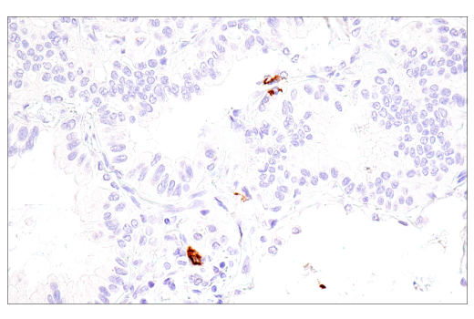Immunohistochemistry Image 3: CD1A (MTB1) Mouse mAb