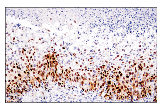 Immunohistochemistry Image 1: Cyclin D1 (E3P5S) XP<sup>®</sup> Rabbit mAb