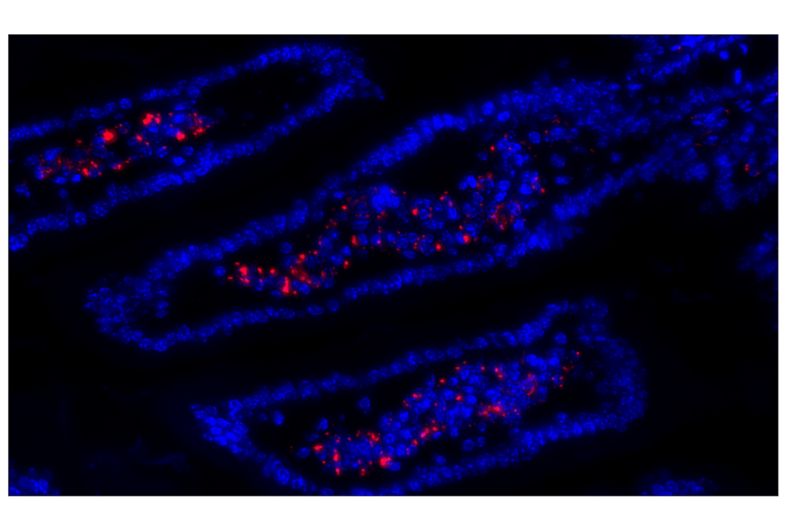 Immunohistochemistry Image 1: CD68 (E3O7V) Rabbit mAb (Alexa Fluor<sup>®</sup> 647 Conjugate)