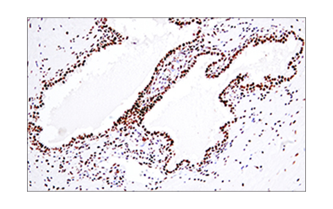 Immunohistochemistry Image 6: 53BP1 (E7N5D) XP<sup>®</sup> Rabbit mAb (BSA and Azide Free)