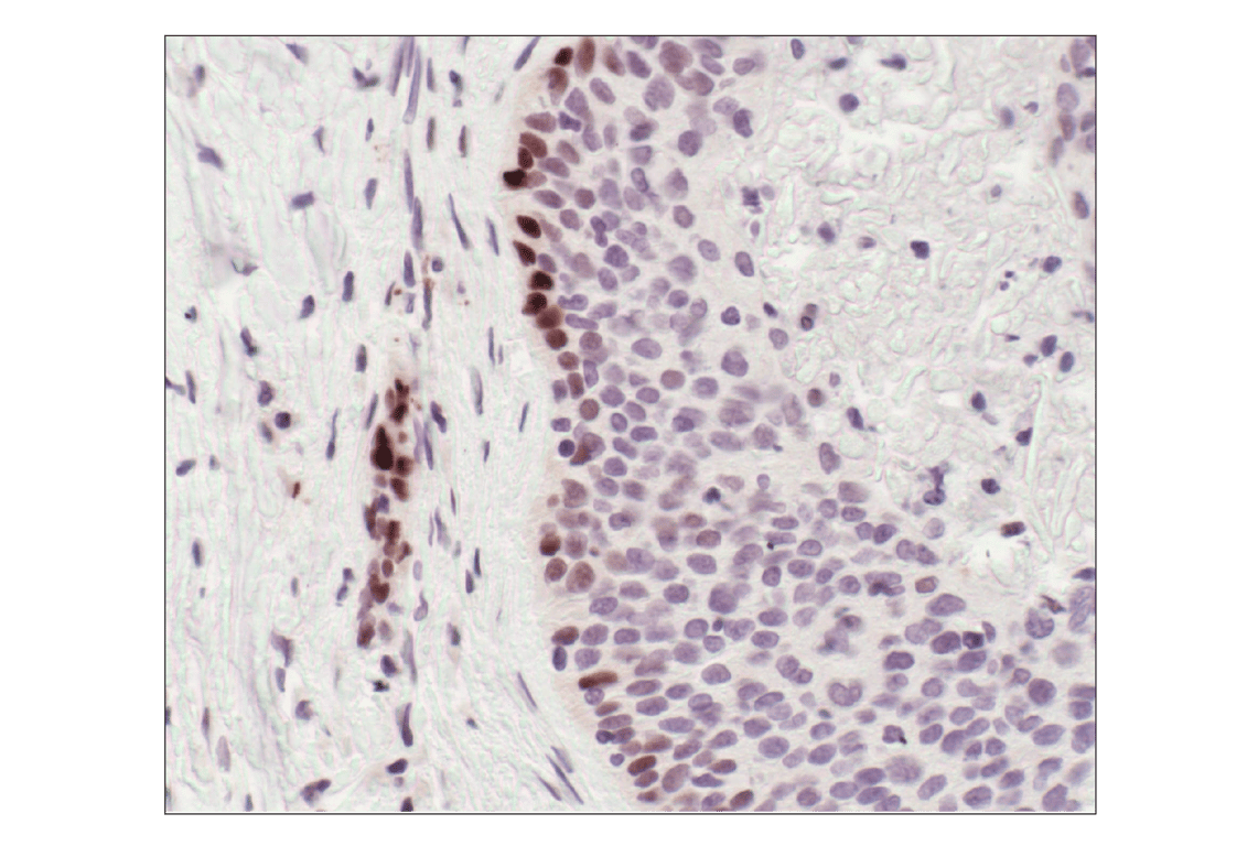 undefined Image 41: ALK Activation Antibody Sampler Kit