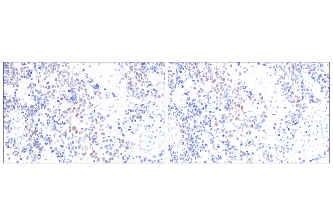 Immunohistochemistry Image 6: MASTL (F7I2C) Rabbit mAb