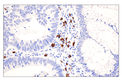 Immunohistochemistry Image 1: CD20 (E7B7T) XP<sup>®</sup> Rabbit mAb