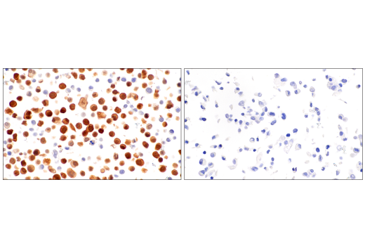 Immunohistochemistry Image 11: Calretinin (CAL6) Mouse mAb