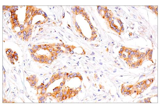 Immunohistochemistry Image 3: G3BP1 (E9G1M) XP<sup>®</sup> Rabbit mAb