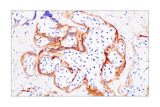 Immunohistochemistry Image 1: SARS-CoV-2 Nucleocapsid Protein (E8R1L) Mouse mAb