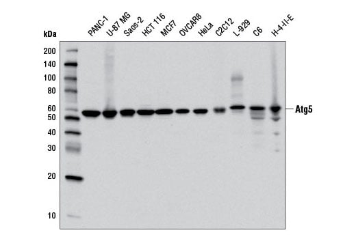 Western Blotting Image 1: Atg5 (D5F5U) Rabbit mAb