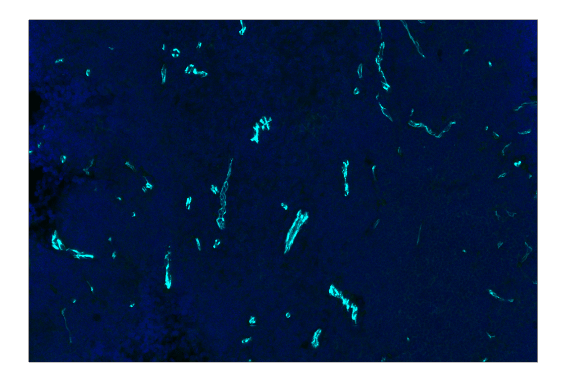 Immunohistochemistry Image 2: CD31 (PECAM-1) (D8V9E) XP<sup>®</sup> Rabbit mAb (Alexa Fluor<sup>®</sup> 750 Conjugate)