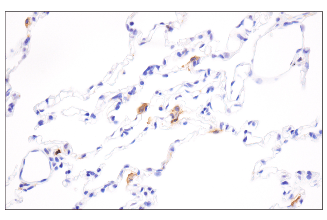 Immunohistochemistry Image 9: HLA-DRA (E9R2Q) XP<sup>®</sup> Rabbit mAb