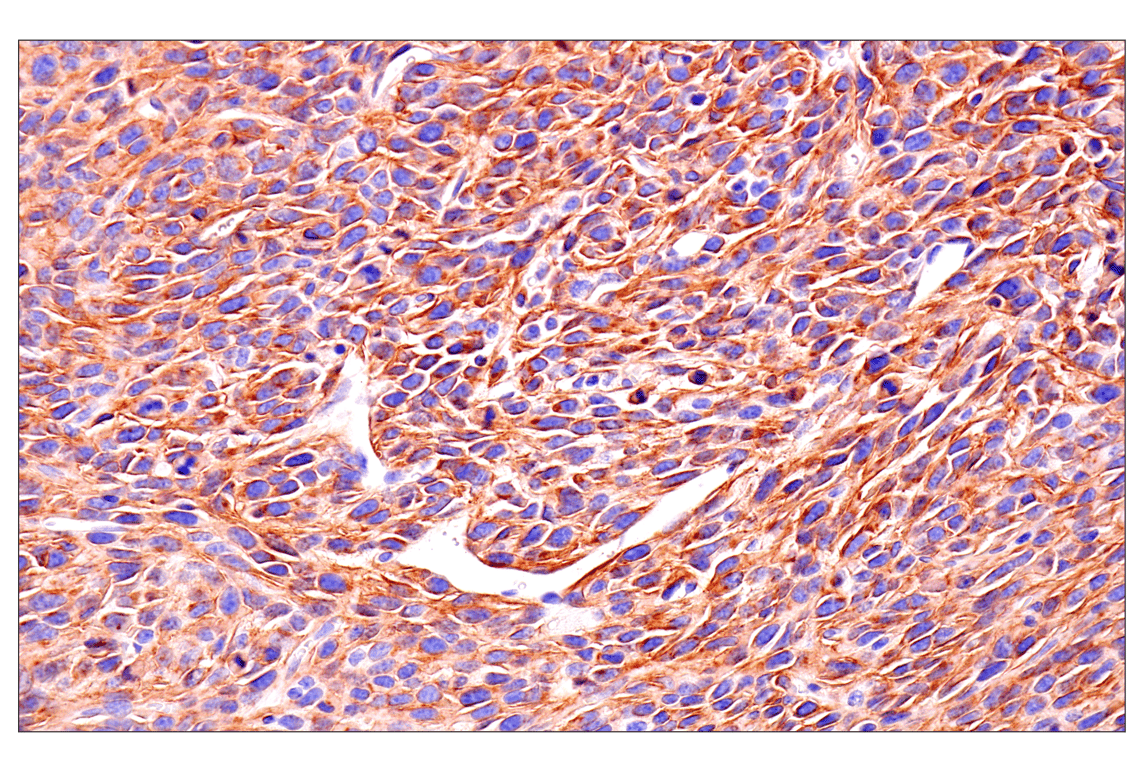 Immunohistochemistry Image 3: Axl (E3Z2H) Rabbit mAb (BSA and Azide Free)