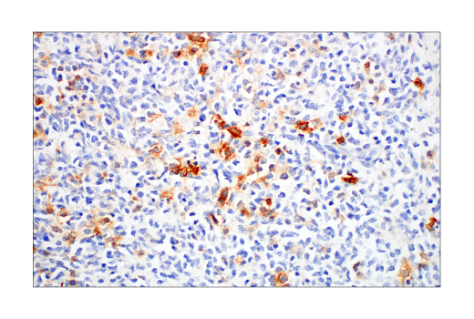 Immunohistochemistry Image 3: TNFRSF8/CD30 (E7E4D) XP<sup>®</sup> Rabbit mAb (BSA and Azide Free)