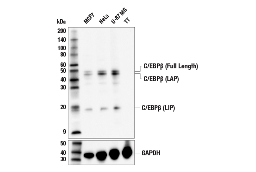 Western Blotting Image 1: C/EBPβ (E7E5D) Rabbit mAb